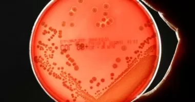 اكتشاف بكتيريا قادرة على التظاهر بالموت حتى فى بيئة معقمة.. اعرف التفاصيل
