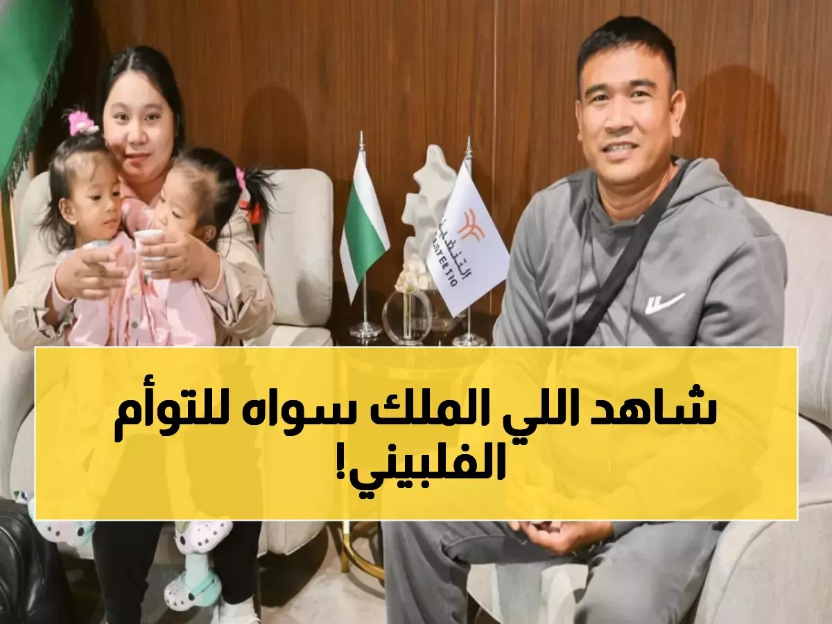 وصول التوأم الفلبيني الملتصق إلى الرياض لعملية فصل مجانية بأمر ملكي - والأطباء يبدأون الفحوصات فوراً!