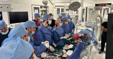 فريق طبى بمستشفى العاصمة الجديدة يشارك ببث حى لقسطرة قلبية معقدة.. صور