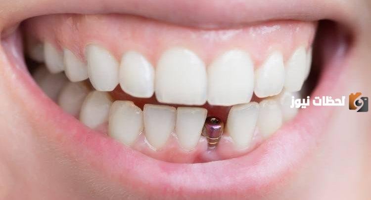 افضل دكتور تركيبات اسنان بالرياض