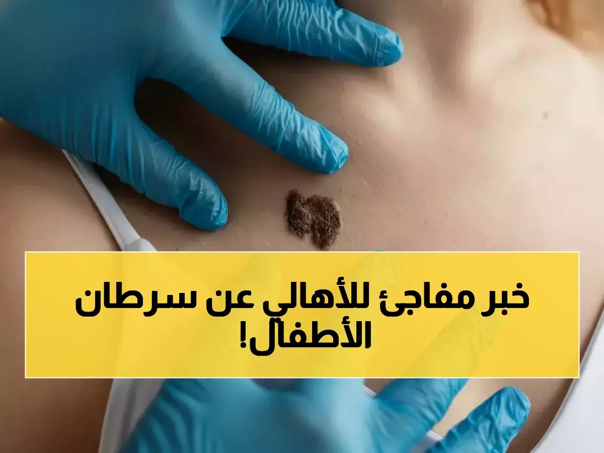  انخفاض مذهل بنسبة 47% في سرطان الجلد عند الأطفال... السر وراء هذا التحول الطبي المفاجئ!