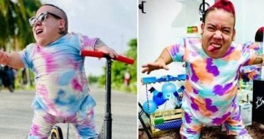 وفاة انفلونسر كولومبى تشعل السوشيال ميديا بسبب إصابته باضطراب نمو العظام