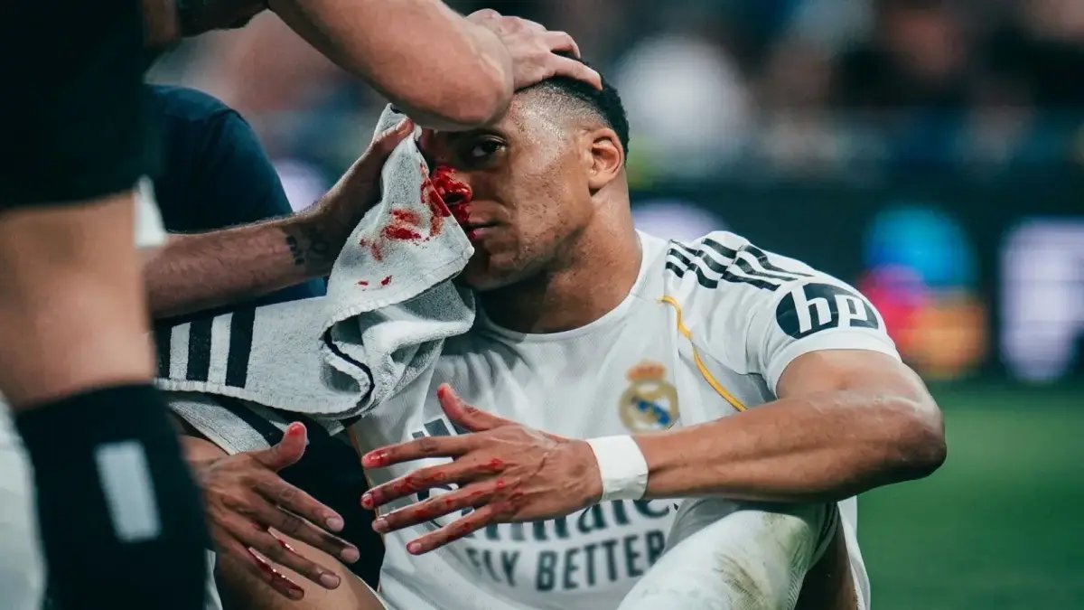 عاجل: ريال مدريد يخاطر بلعب مبابي المصاب في لقاء بايرن المصيري بدوري الأبطال!