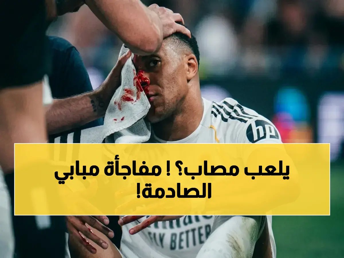  ريال مدريد يخاطر بلعب مبابي المصاب في لقاء بايرن المصيري بدوري الأبطال!